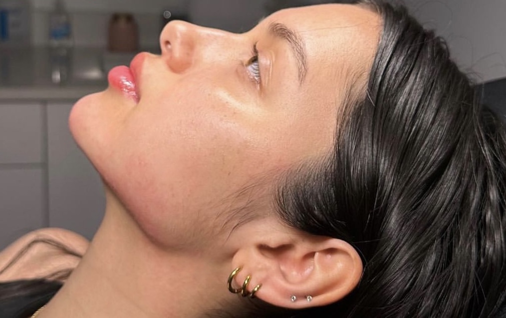 Jawline · Kinn · Cheekbones – Kontur & Volumen